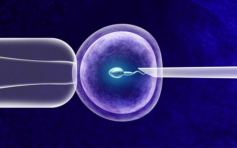 Fertilização in Vitro Dra Thais Vitti Fertilização in Vitro Dra Thais Vitti